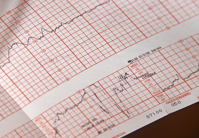 EKG 